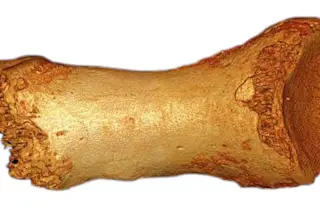 Denisovan toe - Wikimedia 