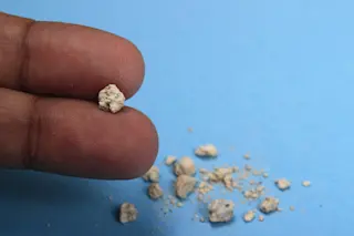 hand holding kidney stone on blue background - shutterstock