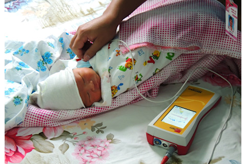 Science and Miracle of Cochlear Implants 2