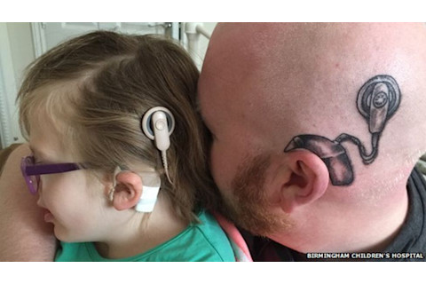Science and Miracle of Cochlear Implants 3