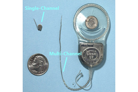 Science and Miracle of Cochlear Implants 10