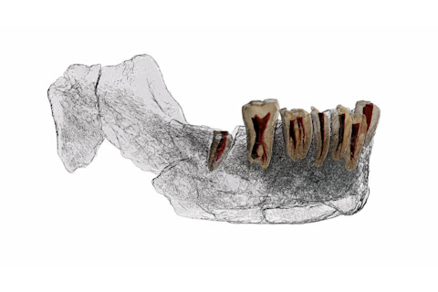 Teeth