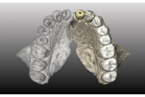 upper jaw Misliya-1 - Weber