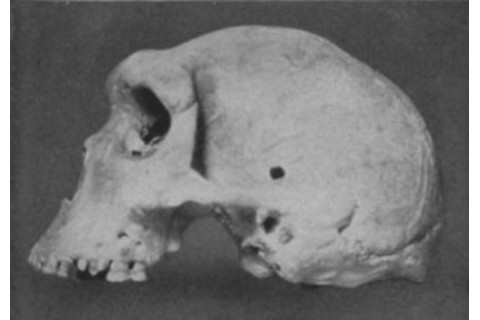 kabwe skull