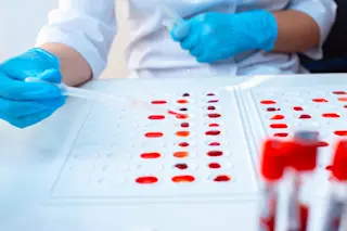 blood type testing lab