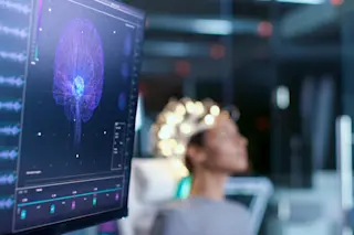 EEG