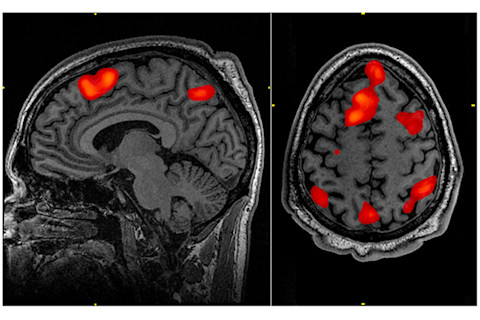 FMRI scan during working memory tasks