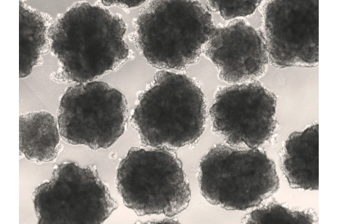 Neanderthalized organoids