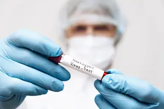 Monkeypox test