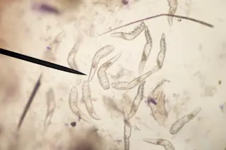 Face mites