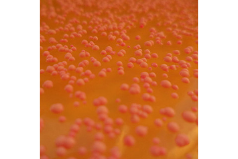 Brettanomyces