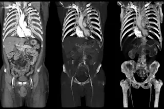 XRAY