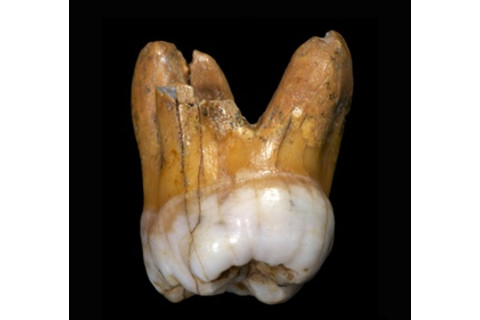 Densiovan Tooth - Max Planck
