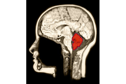 Cerebellum Migraines - Science Source