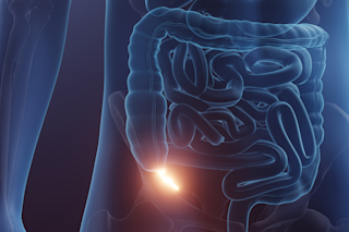 The appendix
