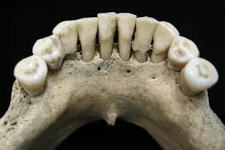 teethartist