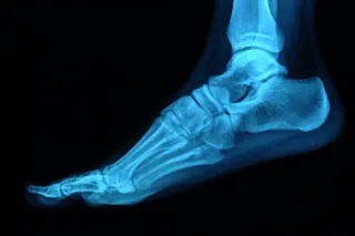 Foot x-ray
