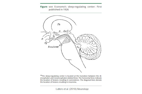 von Economo - Neurology