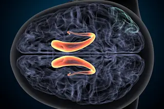 Lateral ventricles