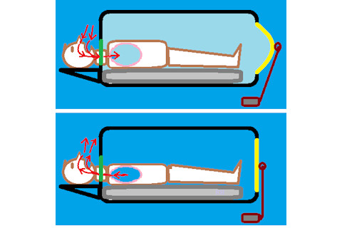 Iron lung action diagrams