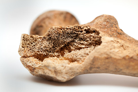 Human femur (Thigh bone); extreme closeup of human bone texture