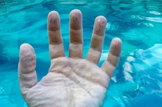Pruney Hands