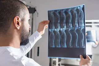 Radiologist analysing X-ray image with human spine in consulting room