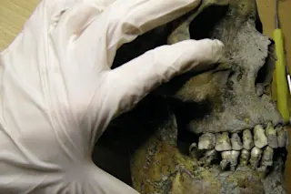 Examining Viking Teeth 