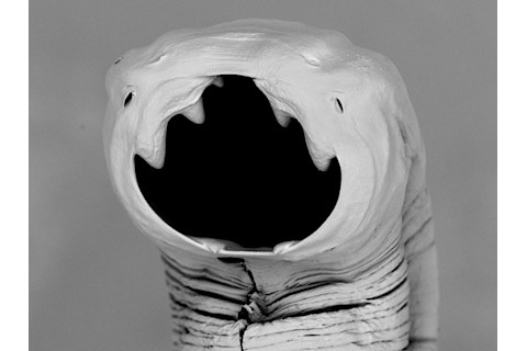 hookworm