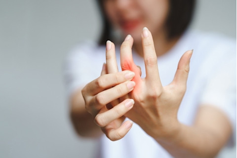 joint pain with arithritus in fingers
