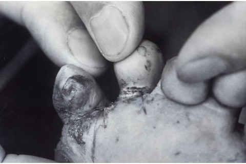 Is Cat Poop a Health Hazzord: Risks You Must Know Now