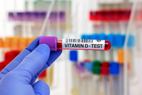 Blood sample of patient for Vitamin D test in laboratory. Hand doctor with Blood tube for Vitamin D test