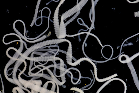 The study of Tapeworm infection is caused by ingesting food or water contaminated with tapeworm eggs or larvae in laboratory.