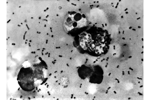 Yersinia pestis bacteria which caused Bubonic Plague. 1965.