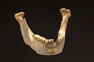 Neanderthal Teeth