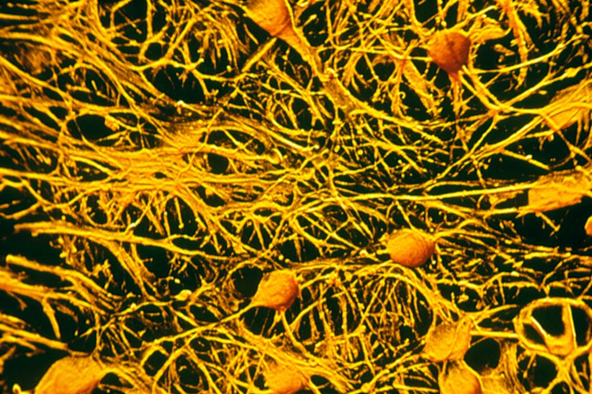 Human Brain Cells - Science Source