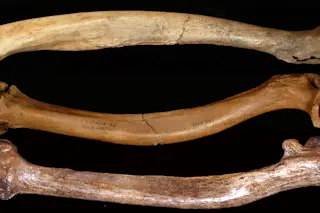 Deformed femurs