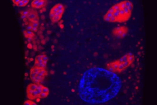 Cool Killers: The Beauty of Deadly Pathogens | Discover Magazine