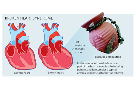 broken-heart-diagram.png