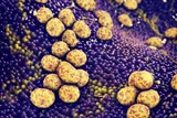 Staph infection