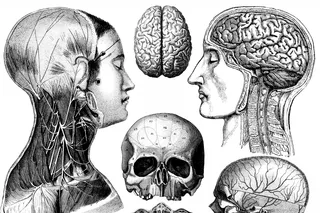 human head transplant graphic