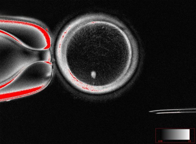 Researchers at OHSU have demonstrated a new technique to treat infertility by turning skin cells into oocytes, or eggs. Shown here, an image of an oocyte with a bright image of a skin cell nucleus before fertilization.