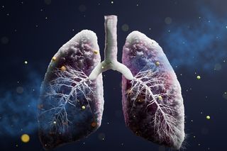 vector image of infected lungs