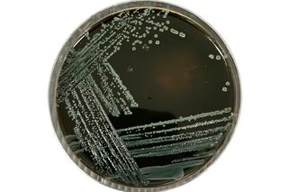 Listeria monocytogenes on PALCAM agar 
