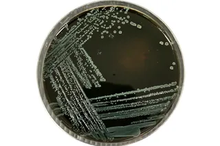 Listeria monocytogenes on PALCAM agar Listeria monocytogenes on PALCAM agar