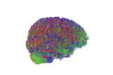 brain scan in era 1