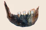Mandible of Homo sapien woman who lived 7,900 years ago in southern Africa