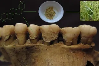 Miliacin biomolecule in the dental calculus of human teeth