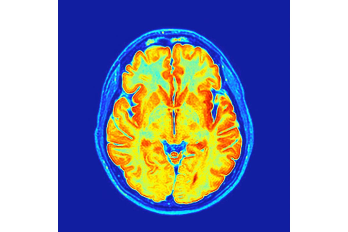 ADHD Drugs May Target Reward Centers, Not Attention Networks | Discover ...