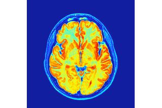 mri scan showing a colorful brain image 